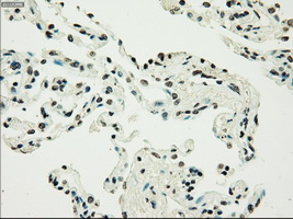 PMEL / SILV / gp100 Antibody - IHC of paraffin-embedded lung tissue using anti-SILV mouse monoclonal antibody. (Dilution 1:50).