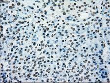PMEL / SILV / gp100 Antibody - IHC of paraffin-embedded pancreas tissue using anti-SILV mouse monoclonal antibody. (Dilution 1:50).