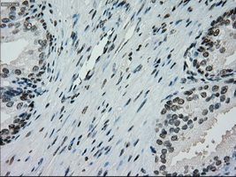 PMEL / SILV / gp100 Antibody - IHC of paraffin-embedded prostate tissue using anti-SILV mouse monoclonal antibody. (Dilution 1:50).