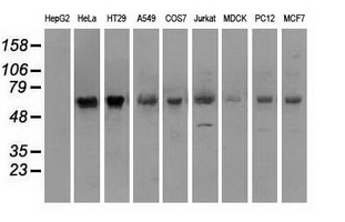 PMEL / SILV / gp100 Antibody - Western blot of extracts (35 ug) from 9 different cell lines by using anti-SILV monoclonal antibody.