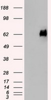 PMEL / SILV / gp100 Antibody - HEK293T cells were transfected with the pCMV6-ENTRY control (Left lane) or pCMV6-ENTRY SILV (Right lane) cDNA for 48 hrs and lysed. Equivalent amounts of cell lysates (5 ug per lane) were separated by SDS-PAGE and immunoblotted with anti-SILV.