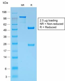 PMEL / SILV / gp100 Antibody - SDS-PAGE Analysis Purified gp100 Rabbit Recombinant Monoclonal Antibody (PMEL/1825R). Confirmation of Purity and Integrity of Antibody.