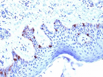 PMEL / SILV / gp100 Antibody - IHC testing of human skin with Melanoma gp100 antibody (clone PMEL/2039). Required HIER: boil tissue sections in 10mM citrate buffer, pH 6, for 10-20 min followed by cooling at RT for 20 min.