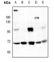 PMEL / SILV / gp100 Antibody - Western blot analysis of HMB45 expression in A375 (A), PC12 (B), AML12 (C), mouse kidney (D), rat ovary (E) whole cell lysates.