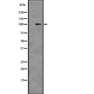 PMEL / SILV / gp100 Antibody - Western blot analysis of PMEL17/GP100 using 293 whole cells lysates
