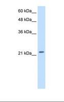 PMF1 Antibody - Transfected 293T cell lysate. Antibody concentration: 2.5 ug/ml. Gel concentration: 12%.  This image was taken for the unconjugated form of this product. Other forms have not been tested.
