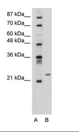 PMF1 Antibody - Transfected 293T Cell Lysate.  This image was taken for the unconjugated form of this product. Other forms have not been tested.