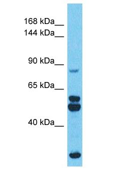 PMFBP1 Antibody - PMFBP1 antibody Western Blot of Uterus Tumor. Antibody dilution: 1 ug/ml.  This image was taken for the unconjugated form of this product. Other forms have not been tested.
