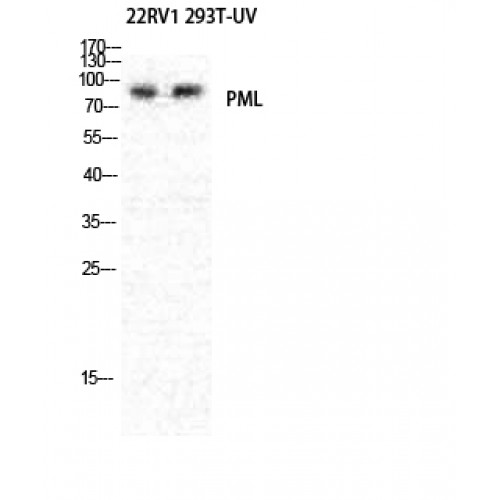 PML Antibody - Western blot of PML antibody