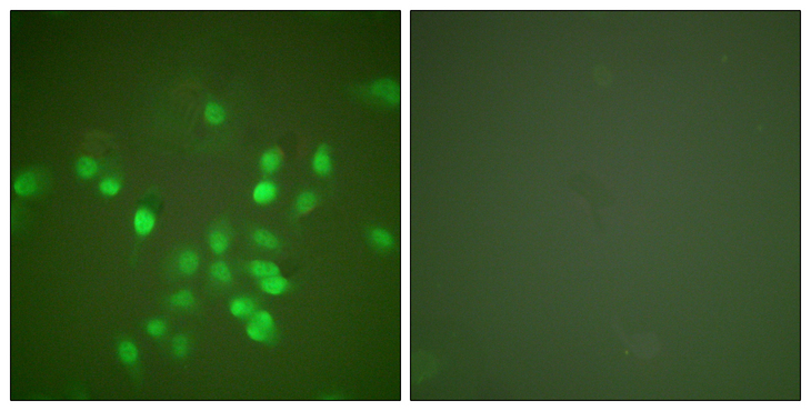 PML Antibody - Immunofluorescence analysis of A549 cells, using PML Antibody. The picture on the right is blocked with the synthesized peptide.