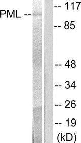 PML Antibody - Western blot analysis of lysates from A549 cells, using PML Antibody. The lane on the right is blocked with the synthesized peptide.