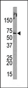 PML Antibody - Western blot of anti-PML Sumoylation Site Antibody in HeLa cell line lysates (35 ug/lane). PML (arrow) was detected using the purified antibody.