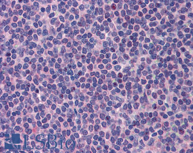 PML Antibody - Anti-PML antibody IHC of human spleen. Immunohistochemistry of formalin-fixed, paraffin-embedded tissue after heat-induced antigen retrieval. Antibody concentration 5 ug/ml.  This image was taken for the unconjugated form of this product. Other forms have not been tested.