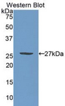 PML Antibody - Western blot of recombinant PML.  This image was taken for the unconjugated form of this product. Other forms have not been tested.