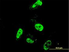 PML Antibody - Immunofluorescence of monoclonal antibody to PML on HeLa cell. [antibody concentration 10 ug/ml]
