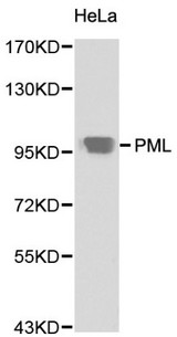 PML Antibody - Western blot of PML pAb in extracts from Hela cells.