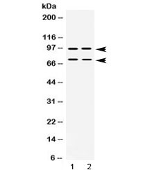 PML Antibody - Western blot testing of human 1) SW620 and 2) U-2 OS lysate with PML antibody at 0.5ug/ml. Expected molecular weight: multiple isoforms from 47-97 kDa.
