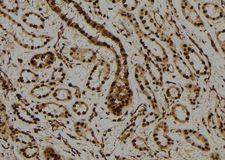 PML Antibody - 1:100 staining human kidney tissue by IHC-P. The sample was formaldehyde fixed and a heat mediated antigen retrieval step in citrate buffer was performed. The sample was then blocked and incubated with the antibody for 1.5 hours at 22°C. An HRP conjugated goat anti-rabbit antibody was used as the secondary.