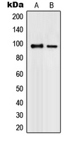 PML Antibody - Western blot analysis of PML expression in K562 (A); COLO320 (B) whole cell lysates.