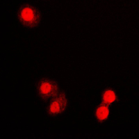 PML Antibody - Immunofluorescent analysis of PML staining in COLO320 cells. Formalin-fixed cells were permeabilized with 0.1% Triton X-100 in TBS for 5-10 minutes and blocked with 3% BSA-PBS for 30 minutes at room temperature. Cells were probed with the primary antibody in 3% BSA-PBS and incubated overnight at 4 C in a humidified chamber. Cells were washed with PBST and incubated with a DyLight 594-conjugated secondary antibody (red) in PBS at room temperature in the dark. DAPI was used to stain the cell nuclei (blue).
