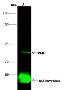 PML Antibody - PML was immunoprecipitated using: Lane A: 0.5 mg A549 Whole Cell Lysate. 4 uL anti-PML rabbit polyclonal antibody and 60 ug of Immunomagnetic beads Protein A/G. Primary antibody: Anti-PML rabbit polyclonal antibody, at 1:100 dilution. Secondary antibody: Goat Anti-Rabbit IgG (H+L)/HRP at 1/10000 dilution. Developed using the ECL technique. Performed under reducing conditions. Predicted band size: 48-98 kDa. Observed band size: 85 kDa.