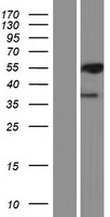 PML Protein - Western validation with an anti-DDK antibody * L: Control HEK293 lysate R: Over-expression lysate