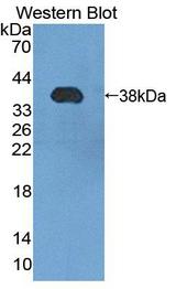 PMM1 Antibody - Western blot of PMM1 antibody.