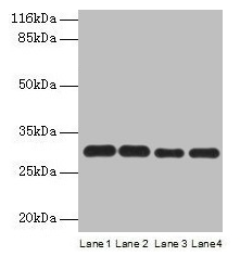 PMM1 Antibody - Western blot All lanes: PMM1 antibody at 2µg/ml Lane 1: HepG2 whole cell lysate Lane 2: NIH/3T3 whole cell lysate Lane 3: 293T whole cell lysate Lane 4: Mouse brain tissue Secondary Goat polyclonal to rabbit IgG at 1/10000 dilution Predicted band size: 30 kDa Observed band size: 30 kDa