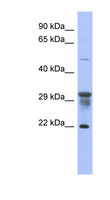 PMM1 Antibody - PMM1 antibody Western blot of 293T cell lysate. This image was taken for the unconjugated form of this product. Other forms have not been tested.