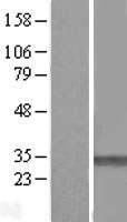PMM1 Protein - Western validation with an anti-DDK antibody * L: Control HEK293 lysate R: Over-expression lysate