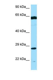 PMM2 Antibody - PMM2 antibody Western blot of MCF7 Cell lysate. Antibody concentration 1 ug/ml.  This image was taken for the unconjugated form of this product. Other forms have not been tested.
