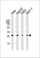 PMM2 Antibody - Western blot of lysates from HeLa, HepG2, K562, MCF-7 cell line (from left to right), using PMM2 Antibody. Antibody was diluted at 1:1000 at each lane. A goat anti-rabbit IgG H&L (HRP) at 1:5000 dilution was used as the secondary antibody. Lysates at 35ug per lane.