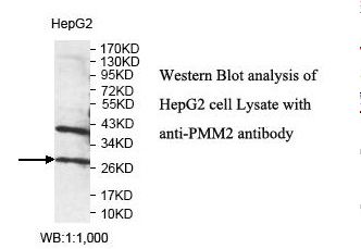 PMM2 Antibody