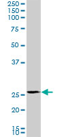 PMM2 Antibody - PMM2 monoclonal antibody (M02), clone 2A5. Western blot of PMM2 expression in K-562.