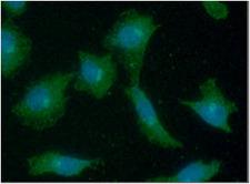 PMM2 Antibody - ICC/IF analysis of PMM2 in A549 cells line, stained with DAPI (Blue) for nucleus staining and monoclonal anti-human PMM2 antibody (1:100) with goat anti-mouse IgG-Alexa fluor 488 conjugate (Green).