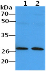 PMM2 Antibody - The Cell lysates (40ug) were resolved by SDS-PAGE, transferred to PVDF membrane and probed with anti-human PMM2 antibody (1:500). Proteins were visualized using a goat anti-mouse secondary antibody conjugated to HRP and an ECL detection system. Lane 1.: A549 cell lysate Lane 2.: HepG2 cell lysate