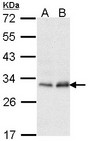 PMM2 Antibody - Sample (30 ug of whole cell lysate). A: Hela. B: Hep G2. 12% SDS PAGE. PMM2 antibody diluted at 1:1000. 