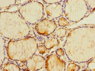 PMM2 Antibody - Immunohistochemistry of paraffin-embedded human thyroid tissue at dilution 1:100