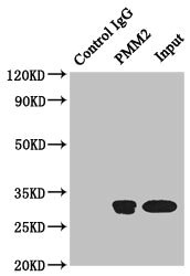 PMM2 Antibody - Immunoprecipitating PMM2 in HeLa whole cell lysate Lane 1: Rabbit monoclonal IgG(1ug)instead of product in HeLa whole cell lysate.For western blotting, a HRP-conjugated anti-rabbit IgG, specific to the non-reduced form of IgG was used as the Secondary antibody (1/50000) Lane 2: product(4ug)+ HeLa whole cell lysate(500ug) Lane 3: HeLa whole cell lysate (20ug)