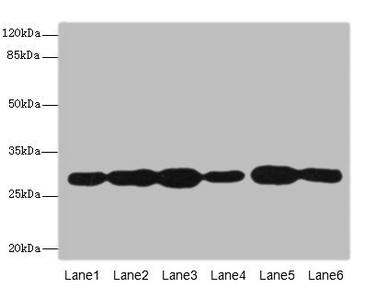 PMM2 Antibody - Western blot All Lanes: PMM2 antibody at 3.8ug/ml Lane 1: A549 whole cell lysate Lane 2: HepG-2 whole cell lysate Lane 3: MCF7 whole cell lysate Lane 4: K562 whole cell lysate Lane 5: Hela whole cell lysate Lane 6: 293T whole cell lysate Secondary Goat polyclonal to rabbit IgG at 1/10000 dilution Predicted band size: 29,14 kDa Observed band size: 28 kDa