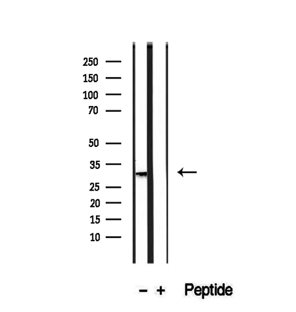 PMM2 Antibody - Western blot analysis of extracts of HepG2 cells using PMM2 antibody.