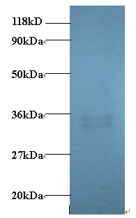 PMP2 / FABP8 Antibody - Western blot of Cytidine deaminase antibody at 2 ug/ml + EC109 whole cell lysate at 20 ug. Secondary: Goat polyclonal to Rabbit IgG at 1:15000 dilution. Predicted band size:14.5 kDa. Observed band size: 35 kDa Additional bands at:33 kDa. We are unsure as to the identity of this extra band.  This image was taken for the unconjugated form of this product. Other forms have not been tested.