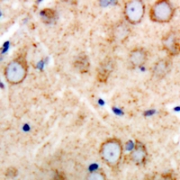 PMP22 Antibody - Immunohistochemical analysis of GAS3 staining in human brain formalin fixed paraffin embedded tissue section. The section was pre-treated using heat mediated antigen retrieval with sodium citrate buffer (pH 6.0). The section was then incubated with the antibody at room temperature and detected with HRP and DAB as chromogen. The section was then counterstained with hematoxylin and mounted with DPX.