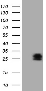 PMP22 Antibody - HEK293T cells were transfected with the pCMV6-ENTRY control. (Left lane) or pCMV6-ENTRY PMP22. (Right lane) cDNA for 48 hrs and lysed. Equivalent amounts of cell lysates. (5 ug per lane) were separated by SDS-PAGE and immunoblotted with anti-PMP22.