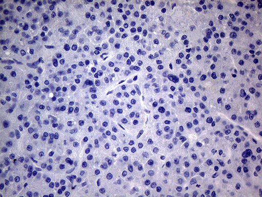 PMP22 Antibody - Immunohistochemical staining of paraffin-embedded Human liver tissue within the normal limits using anti-PMP22 mouse monoclonal antibody.This figure shows negative staining. (Heat-induced epitope retrieval by 1mM EDTA in 10mM Tris buffer. (pH8.5) at 120°C for 3 min. (1:2000)