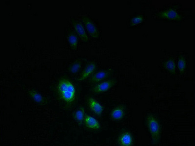 PMP22 Antibody - Immunofluorescent analysis of HepG2 cells using PMP22 Antibody at dilution of 1:100 and Alexa Fluor 488-congugated AffiniPure Goat Anti-Rabbit IgG(H+L)