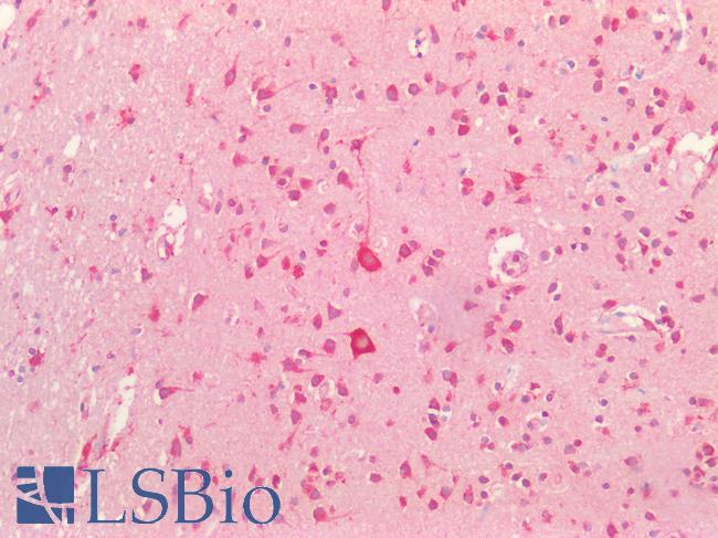 PMP22 Antibody - Human Brain, Cortex: Formalin-Fixed, Paraffin-Embedded (FFPE)