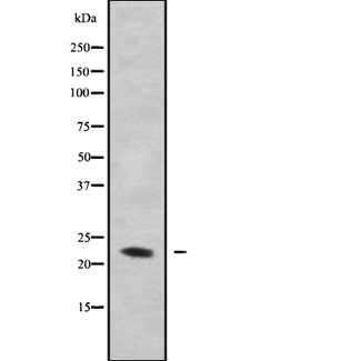 PMP22 Antibody - Western blot analysis GAS3 using MDA-MB-435 whole cells lysates