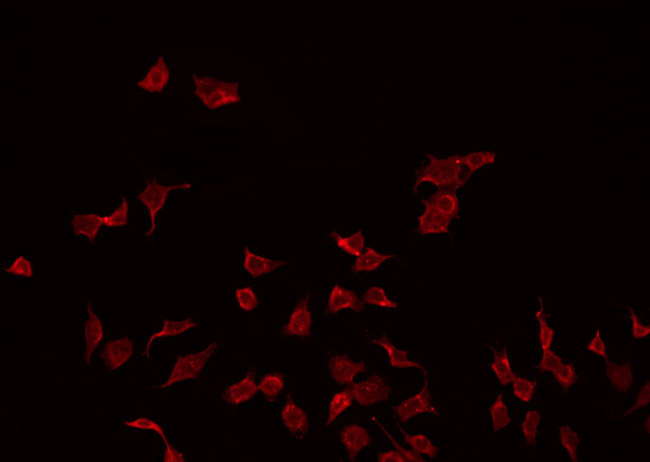 PMP22 Antibody - Staining MDA-MB-435 cells by IF/ICC. The samples were fixed with PFA and permeabilized in 0.1% Triton X-100, then blocked in 10% serum for 45 min at 25°C. The primary antibody was diluted at 1:200 and incubated with the sample for 1 hour at 37°C. An Alexa Fluor 594 conjugated goat anti-rabbit IgG (H+L) Ab, diluted at 1/600, was used as the secondary antibody.