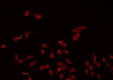 PMP22 Antibody - Staining MDA-MB-435 cells by IF/ICC. The samples were fixed with PFA and permeabilized in 0.1% Triton X-100, then blocked in 10% serum for 45 min at 25°C. The primary antibody was diluted at 1:200 and incubated with the sample for 1 hour at 37°C. An Alexa Fluor 594 conjugated goat anti-rabbit IgG (H+L) Ab, diluted at 1/600, was used as the secondary antibody.